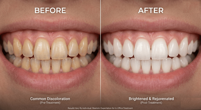 Professional Whitening in Dubai