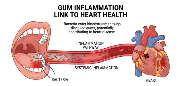Illustration of the proposed link between gum inflammation and heart health